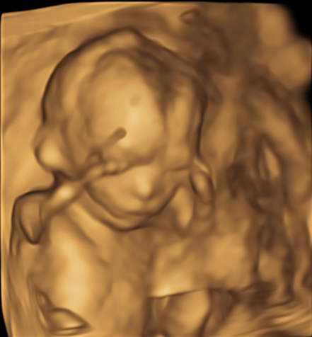 Screen Shot 2018-03-12 at 7.44.35 PM